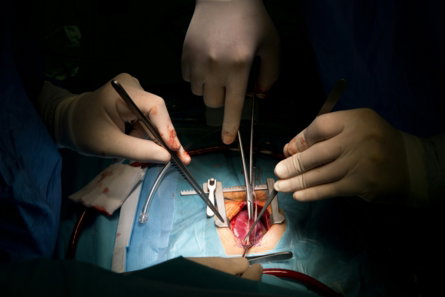 A group of people doing surgery in a dark room